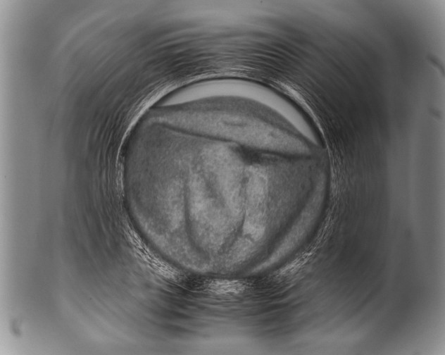 X0000100340835200806261325