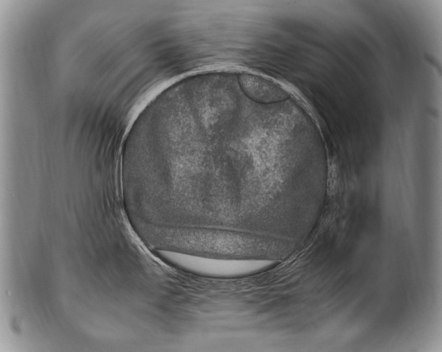 X0000100341295200806261317