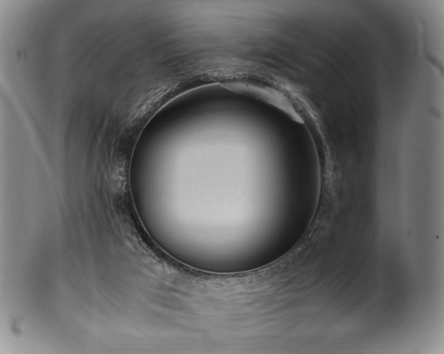 X0000100350017200806061125