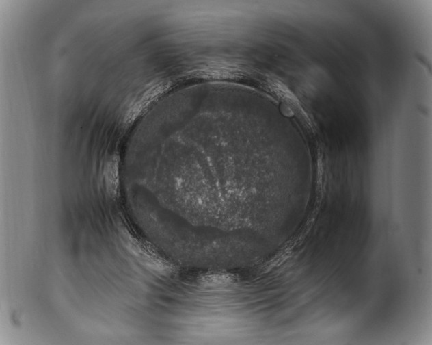 X0000100350202200806061122
