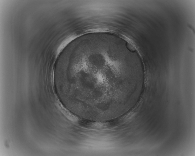 X0000100351179200806061107
