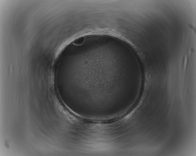 X0000100351506200806061102