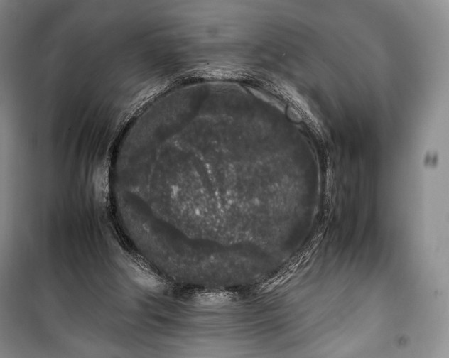X0000100350202200806131000