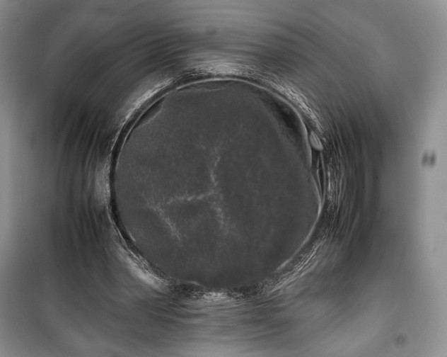 X0000100350390200806130957