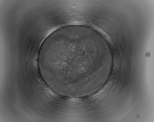 X0000100351170200806130945