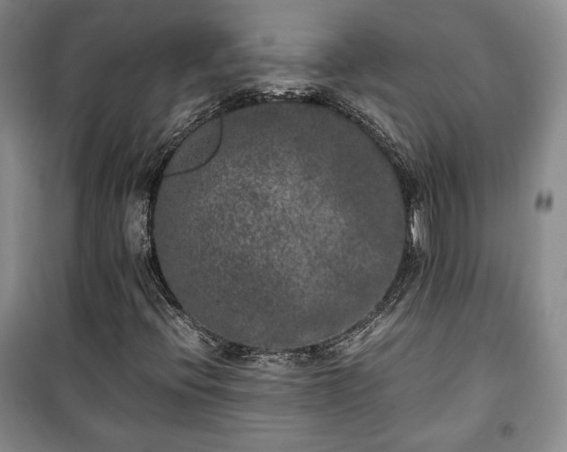 X0000100351396200806130942