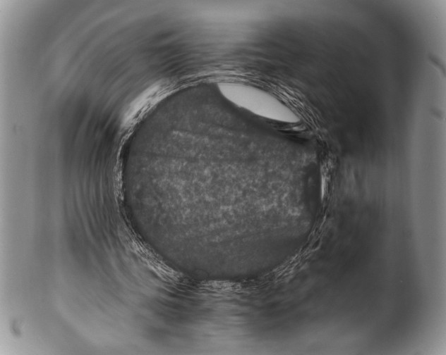 X0000100350339200806201546