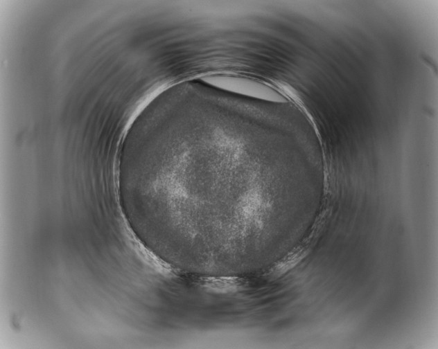 X0000100350859200806201539