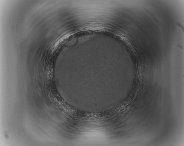 X0000100350920200806201538
