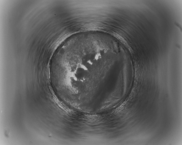 X0000100351031200806201536