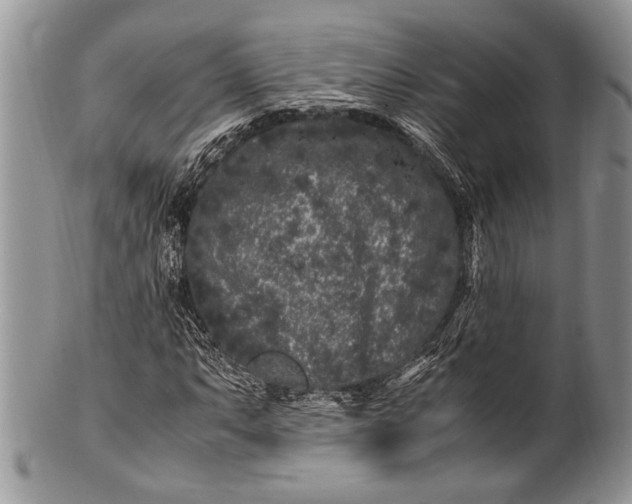 X0000100351063200806201536