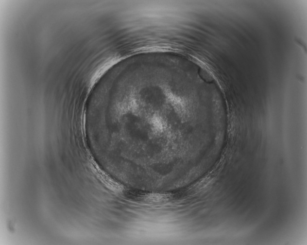 X0000100351179200806201534