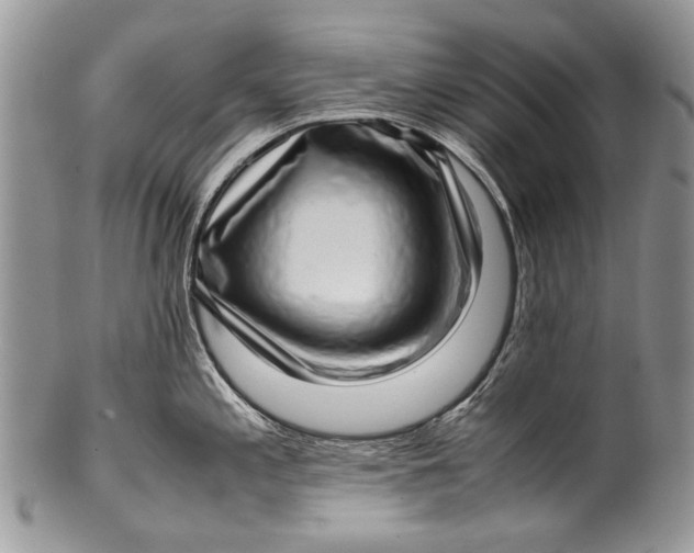 X0000100351197200806201534
