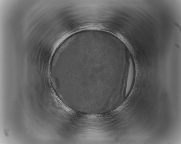 X0000100351240200806201533