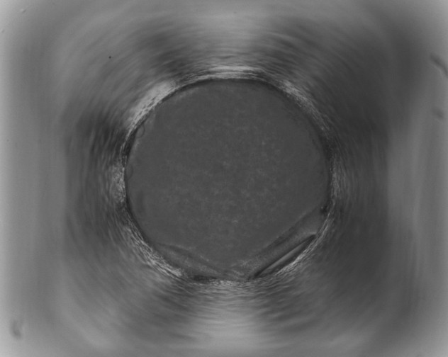 X0000100351362200806201531