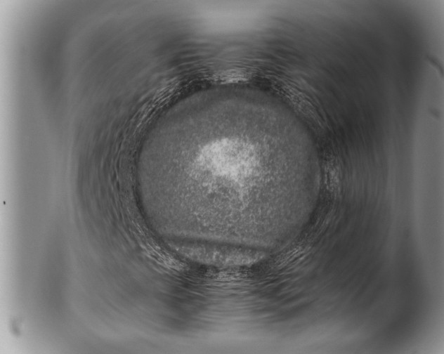 X0000100351393200806201529