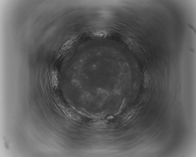 X0000100351394200806201529