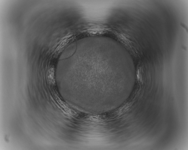 X0000100351396200806201529