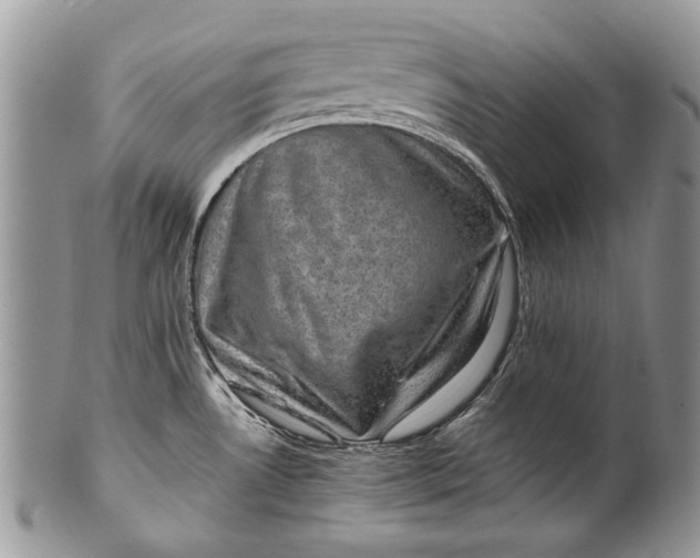 X0000100351530200806201529