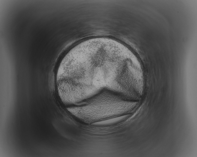 X0000100351171200806271356