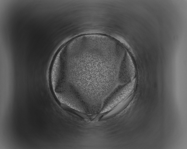 X0000100351181200806271355