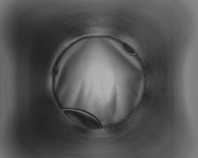 X0000100351472200806271352