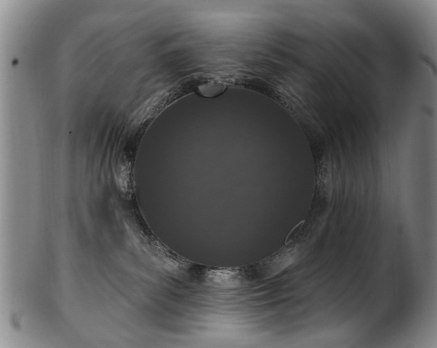 X0000100360139200806061147