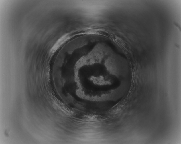 X0000100360295200806061145