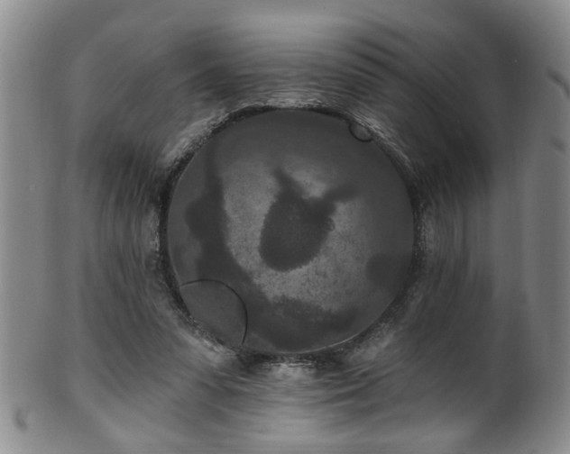 X0000100360303200806061145