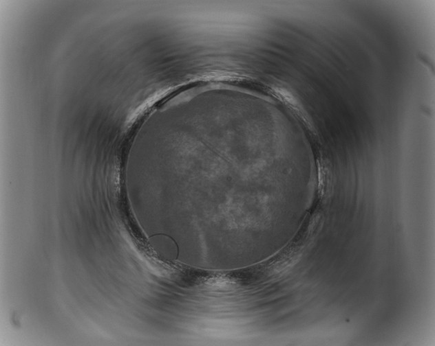 X0000100360348200806061143