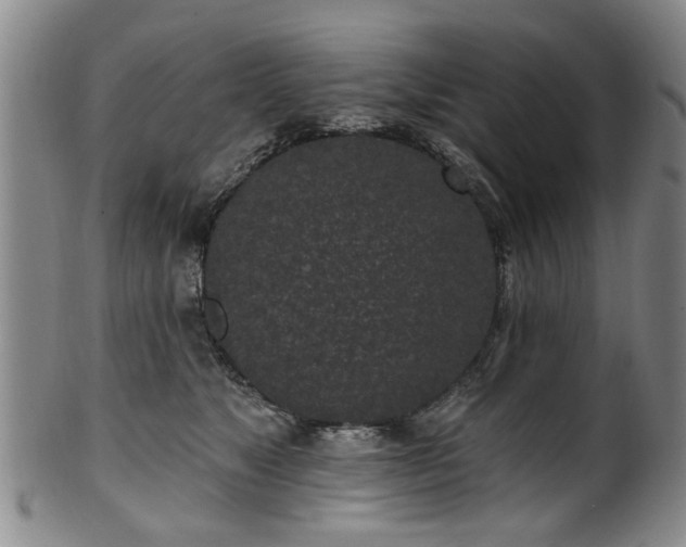 X0000100360517200806061141