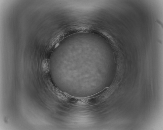 X0000100360720200806061138