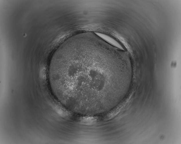 X0000100360161200806131023