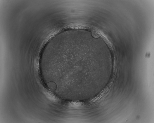 X0000100360202200806131022