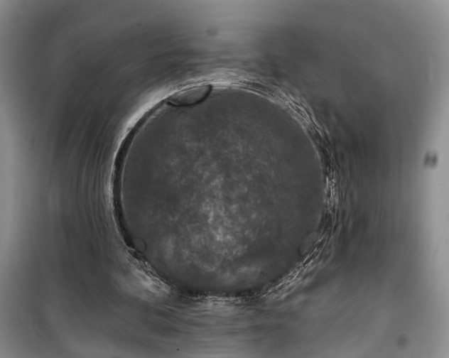 X0000100360292200806131021