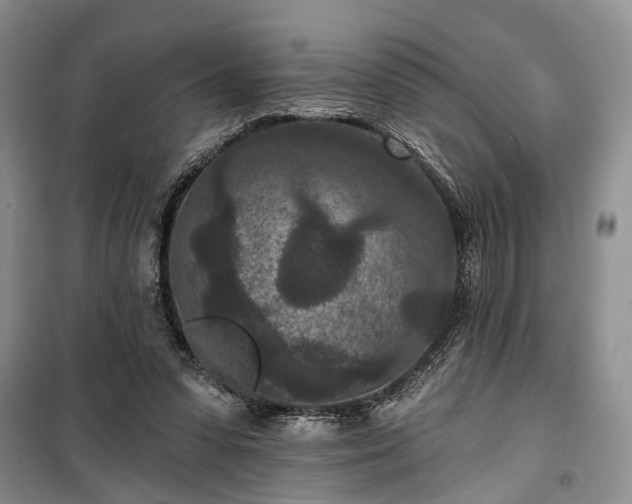 X0000100360303200806131021