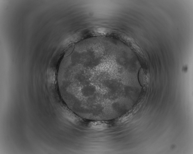 X0000100360331200806131020