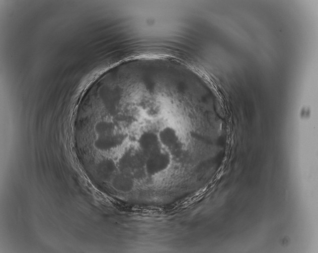 X0000100360337200806131020