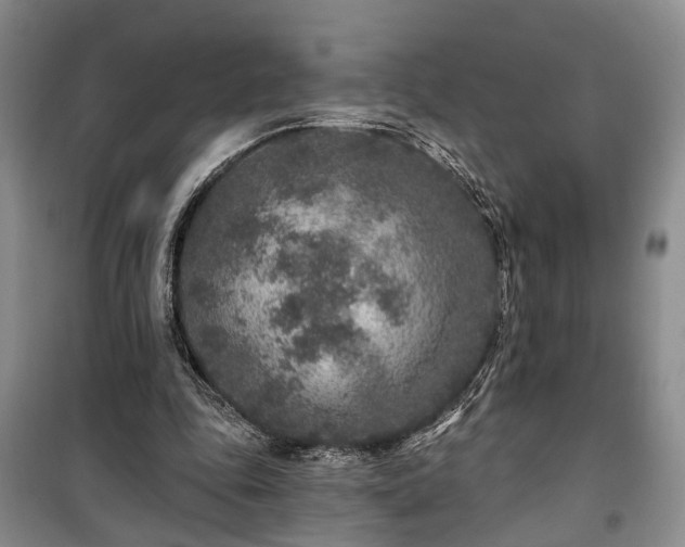 X0000100360343200806131020