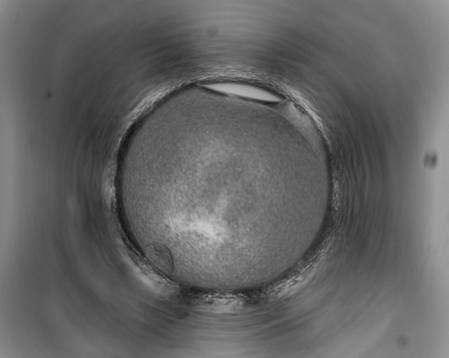 X0000100360443200806131018