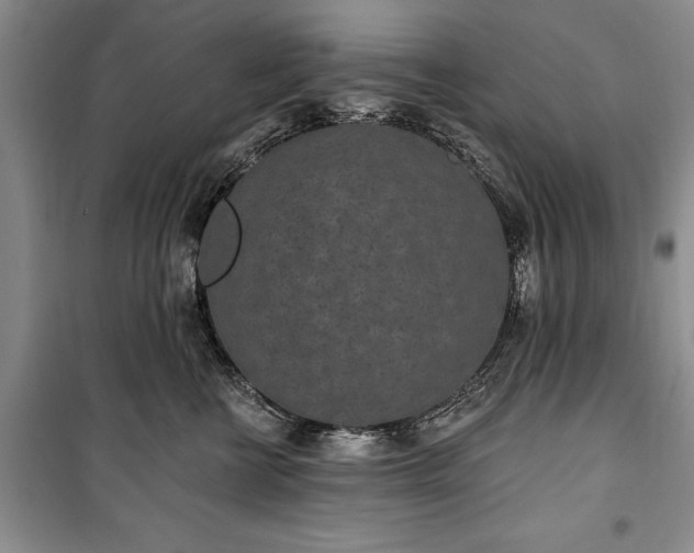 X0000100360570200806131017