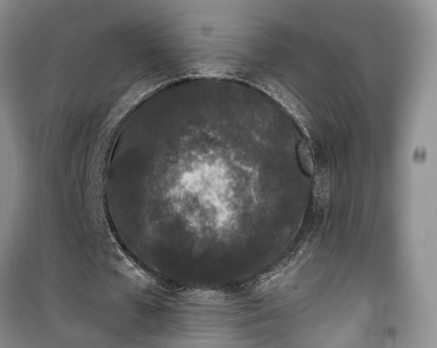 X0000100360577200806131017