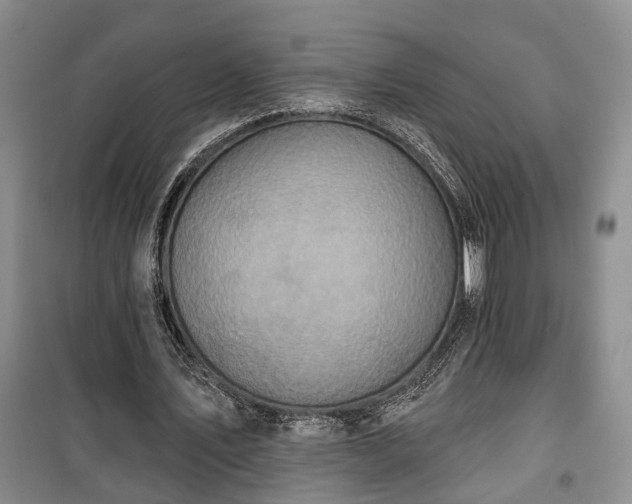 X0000100360579200806131017