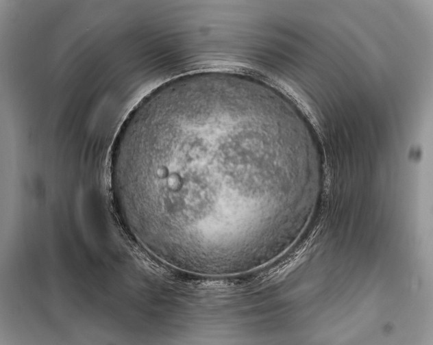 X0000100360883200806131013