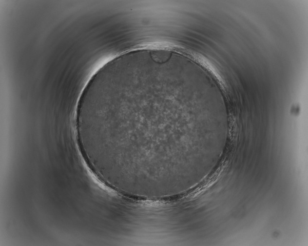 X0000100361087200806131010