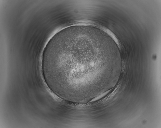 X0000100361099200806131009