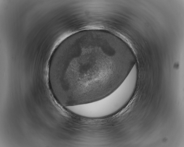 X0000100361179200806131008