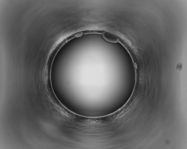 X0000100361270200806131007