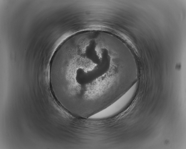 X0000100361275200806131007