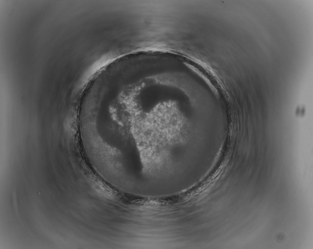 X0000100361359200806131005